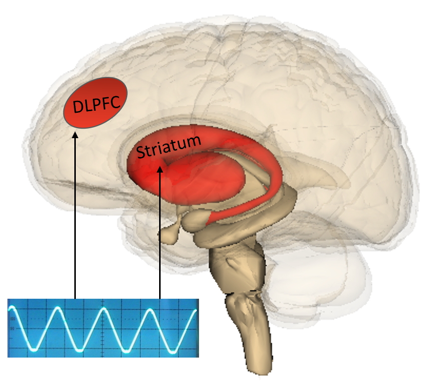 Symbolbild: tAC-Stimulation der für Zwangsstörung relevanten Hirnareale (Dorsolateraler Präfrontalkortex und Striatum)