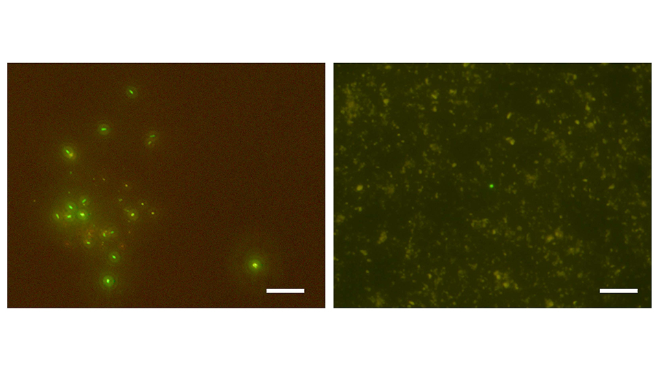 Fluoreszenzmikroskopische Aufnahme der Zellen aus Bohrkernen