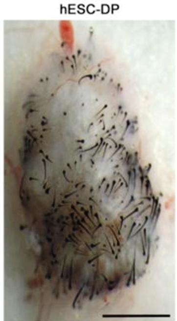 Nach der Transplantation der differenzierten Zellen, bildeten sich an dieser Stelle Haarfollikel aus. Quelle: DOI: 10.1371/journal.pone.0116892